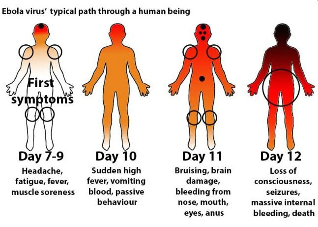 Ebola Virus Path - Human Being