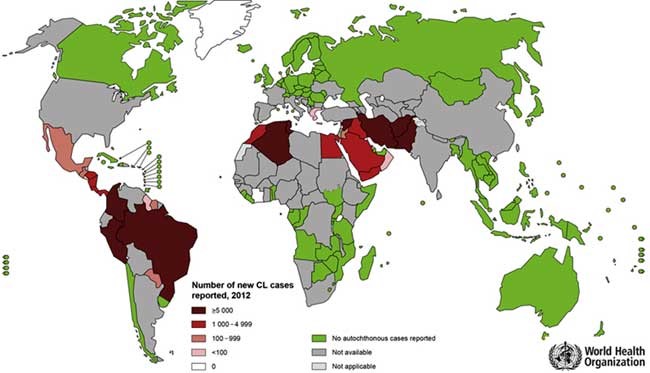 Leishmaniasis Map